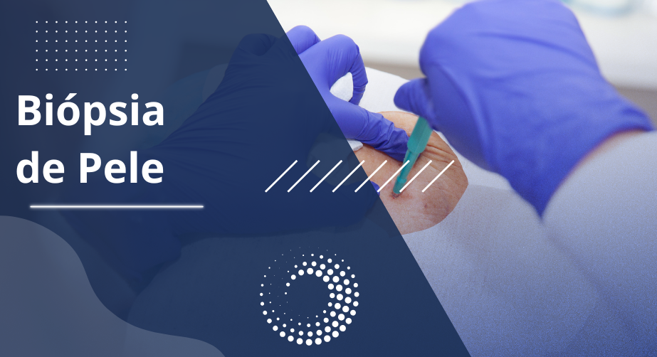 Procedimento dermatológico de biópsia