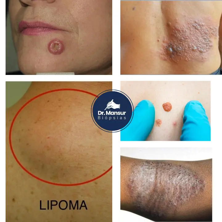 tratamento_especializado